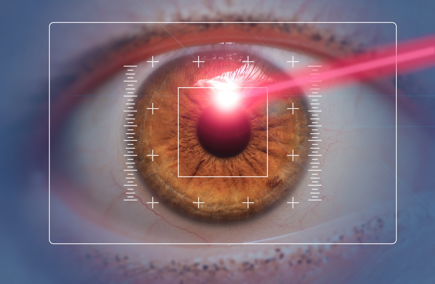 Acuidade Visual a Laser